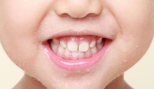 成人牙齿掉落如何修补视频,跟随视频学习修补技巧