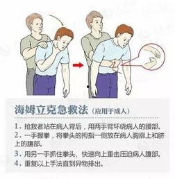 急救成人拍嗝视频大全,成人拍嗝技巧视频大全解析