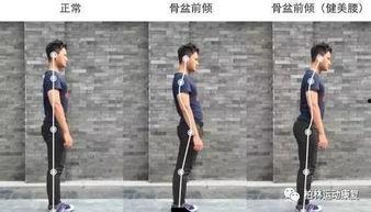 成人防驼背测评视频讲解,视频讲解揭示预防驼背关键