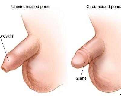 男性成人环切手术视频,男性成人环切手术全程解析与要点回顾