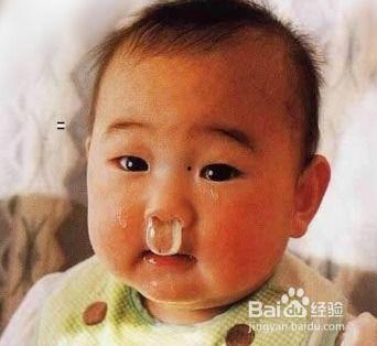 成人止鼻涕方法视频教学