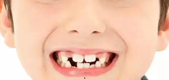 成人板牙怎么换新牙齿视频,视频教程详解