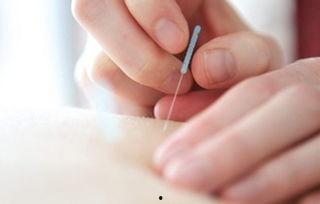 成人学针灸实操视频,成人学习针灸的实用指南